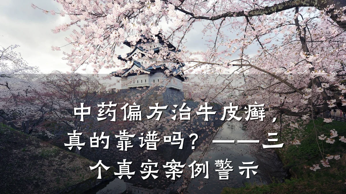 中药偏方治牛皮癣,真的靠谱吗?——三个真实案例警示
