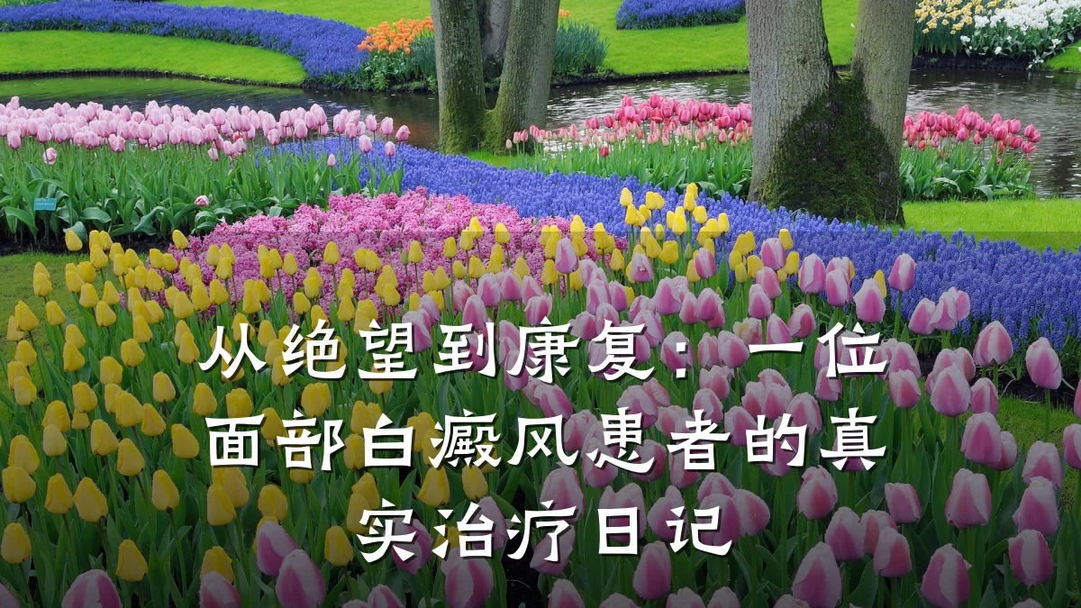 从绝望到康复:一位面部白癜风患者的真实治疗日记